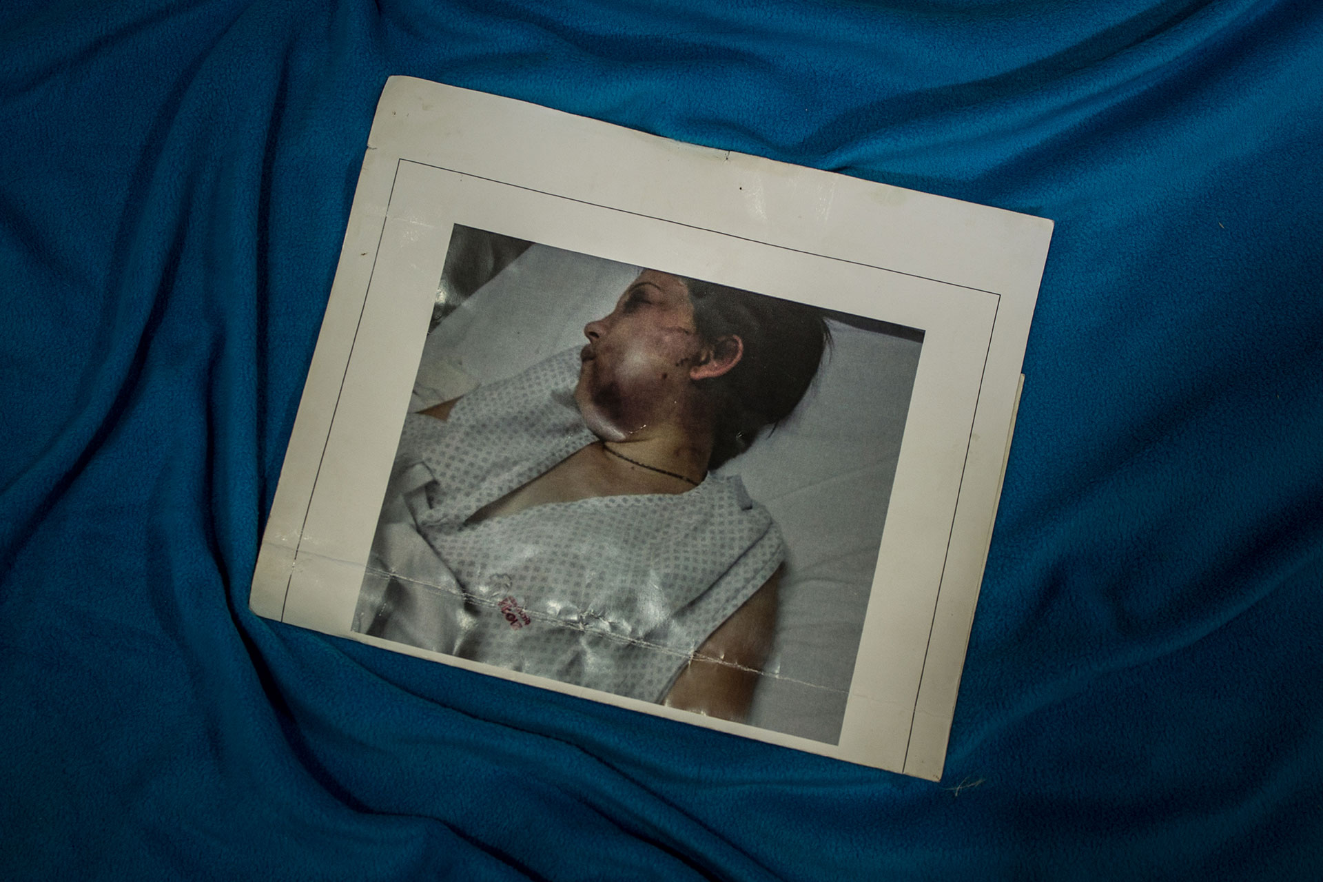 Belén Torres, de 20 años. Esta foto se encontró después de ser atacada.