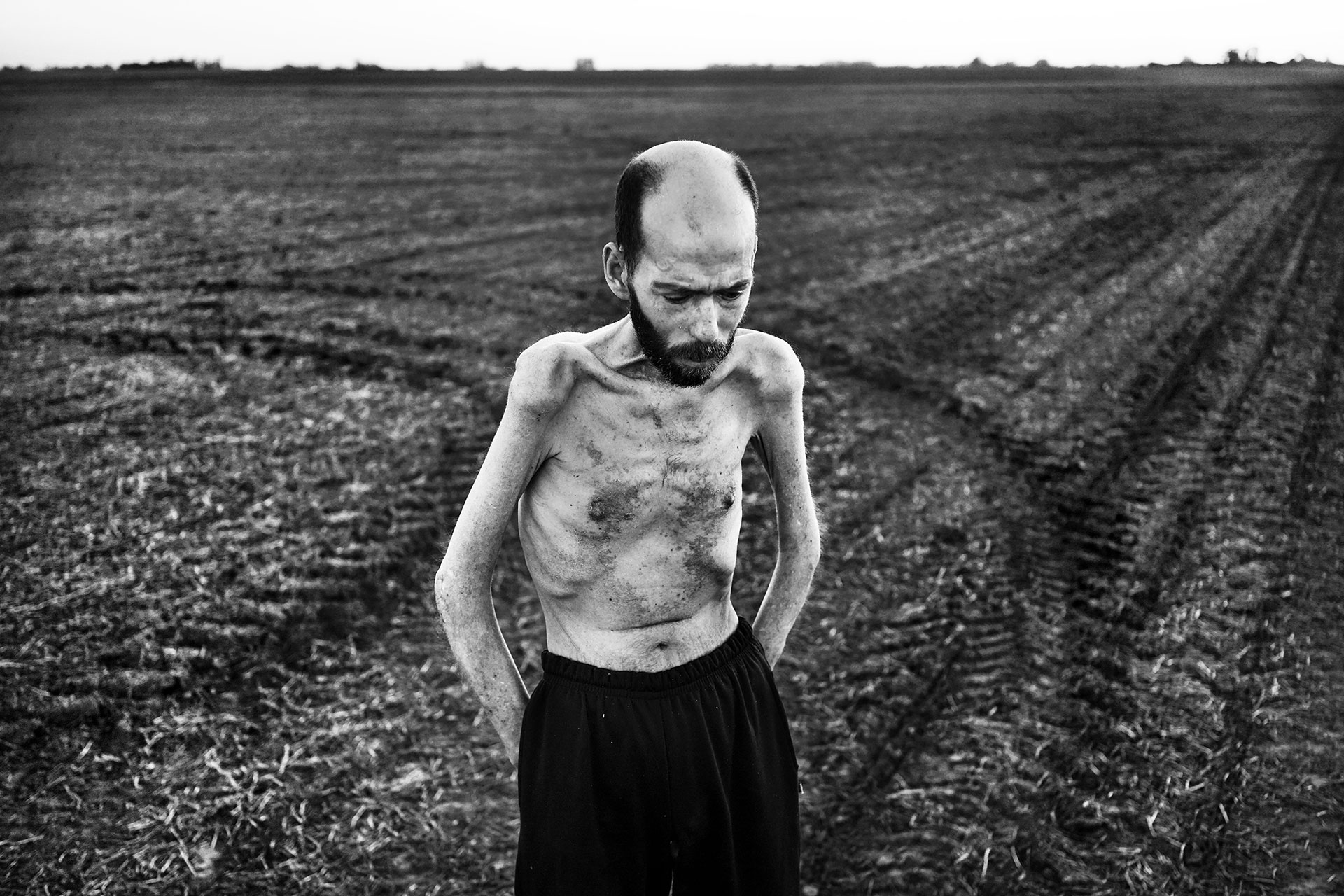 29/10/2016. Entre Ríos, Argentina. For years, Fabián Tomasi worked at loading and pumping jobs for an aerial crop-spraying company. He suffers from severe toxic poly-neuropathy and is currently being treated for general muscular atrophy, which keeps him bed-ridden. Fabián has become a living example of agrochemicals’ impact on human health. He devotes his life to raising awareness of this problem.