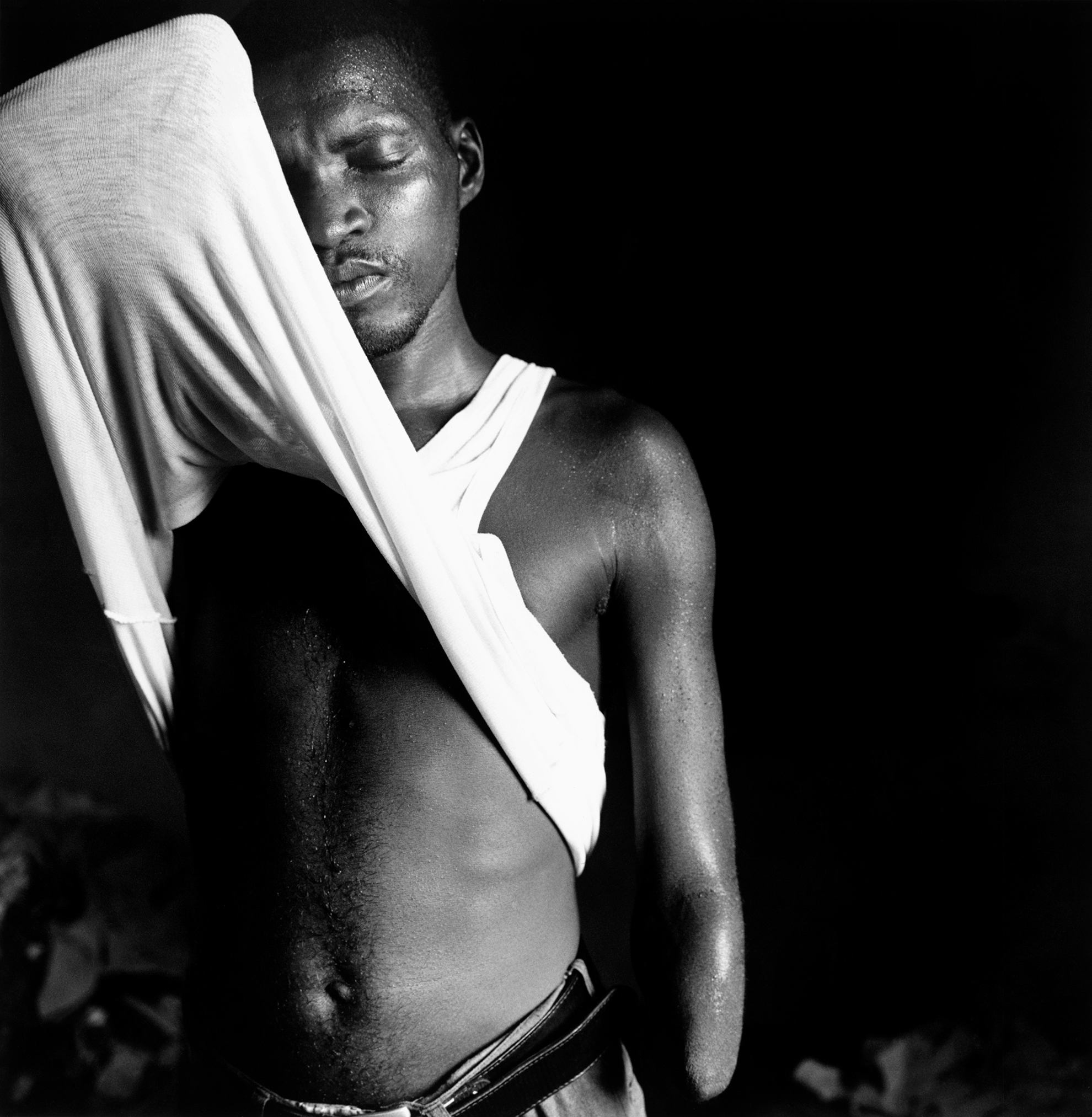 Abu Bakarr Kargbo, de 31 años, mutilado por el Frente Revolucionario Unido, el 20 de enero de 1999 cuando atacaron la parte Este de la capital, Freetown. A diferencia de otras víctimas, no le dieron la posibilidad de elegir entre manga larga o manga corta, perder el brazo o la mano. En la actualidad vive con su esposa y sus tres hijos en un campo para mutilados de guerra abandonado al noroeste de Freetown.