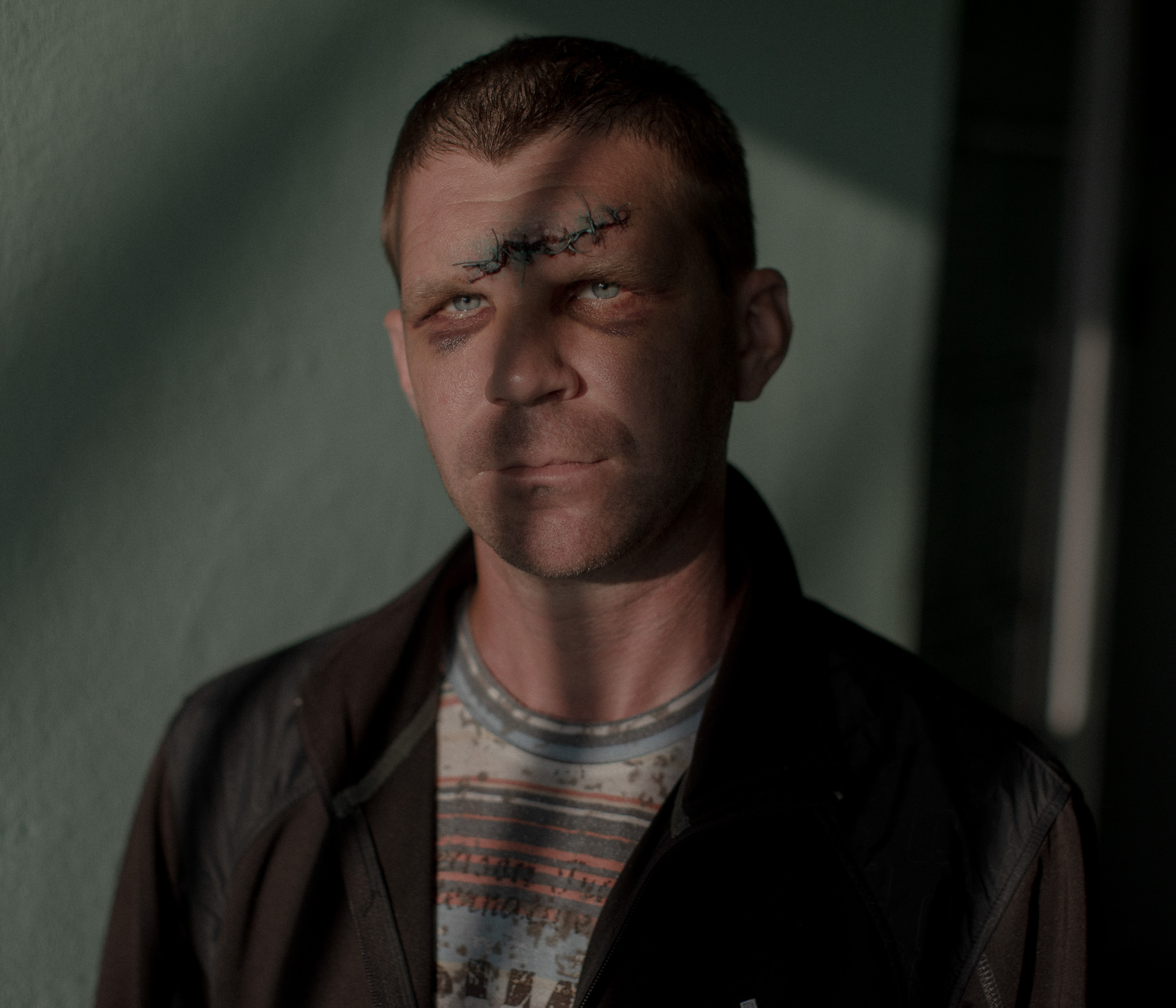 Siergiey - un ex soldado que fue capturado y golpeado por las fuerzas de OMON cuando se dirigía a la tienda en la segunda noche de las protestas (10 de agosto de 2020). En la foto, un hombre posa para un retrato junto a una sala de hospital en el 2º Departamento de Enfermedades Quirúrgicas en Minsk, Bielorrusia.