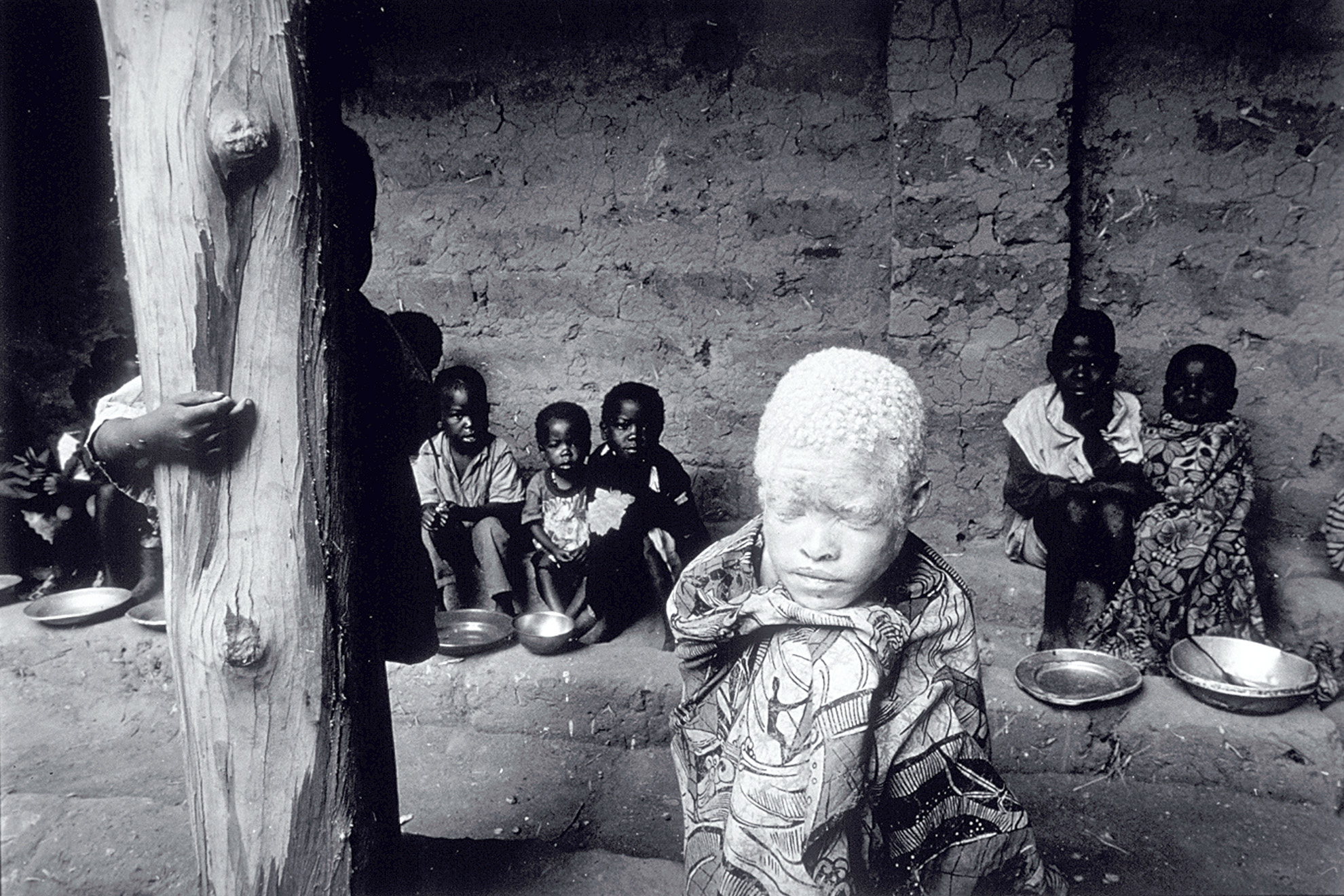 Children receive food from the World Food Programme (WFP) at the Malange reception center. The albino girl has been set apart as an outsider among her people.