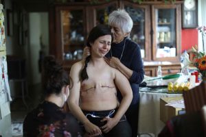 MEXICO CITY (MEXICO), 07/08/2021.- Sandra Monrroy, 36, 3 days after undergoing a bilateral mastectomy due to breast cancer. Her friend Gina Ramirez (l) and her mother Teresa Mandrujano (r) accompany her as she removes the bandage that was placed on her breast.